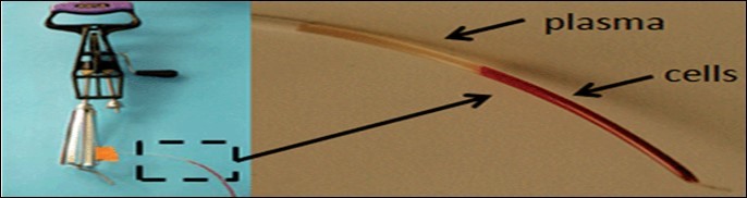 Plasma isolation using an egg beater centrifuge (86).