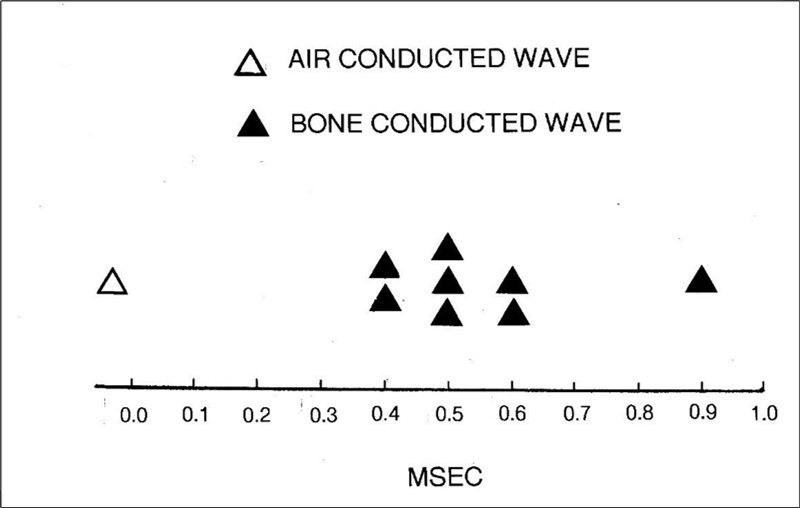 The time difference between an air-conducted BAEP wave and its homologous bone-conducted wave. In this case, the component analyzed is wave V for reasons                    described in the text. The data in the figure is derived from eight separate studies using human adults as subjects.